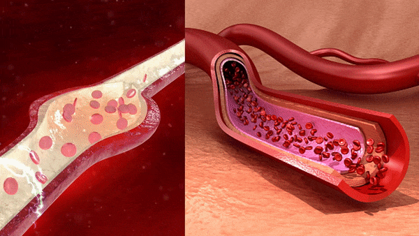 gif1111__PID:288e6253-0bf1-4142-ad65-d6d44132a051